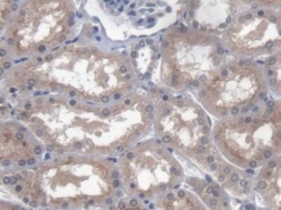 Immunohistochemistry-Paraffin: PTTG1IP Antibody [NBP3-41360] - DAB staining on IHC-P; Samples: Human Kidney Tissue; Primary Ab: 20ug/ml NBP3-41360; Second Ab: 2ug/mL HRP-Linked Caprine Anti-Rabbit IgG Polyclonal Antibody