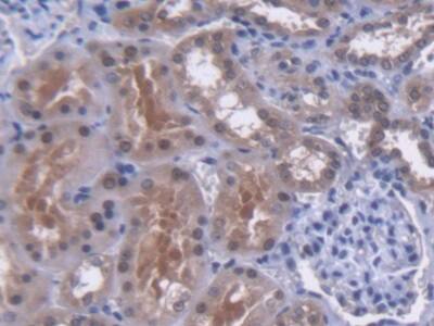 Immunohistochemistry-Paraffin: MYH Antibody [NBP3-41361] - DAB staining on IHC-P; Samples: Human Kidney Tissue; Primary Ab: 20ug/ml NBP3-41361; Second Ab: 2ug/mL HRP-Linked Caprine Anti-Rabbit IgG Polyclonal Antibody