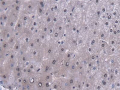 Immunohistochemistry-Paraffin: MYH Antibody [NBP3-41361] - DAB staining on IHC-P; Samples: Human Liver Tissue; Primary Ab: 20ug/ml NBP3-41361; Second Ab: 2ug/mL HRP-Linked Caprine Anti-Rabbit IgG Polyclonal Antibody