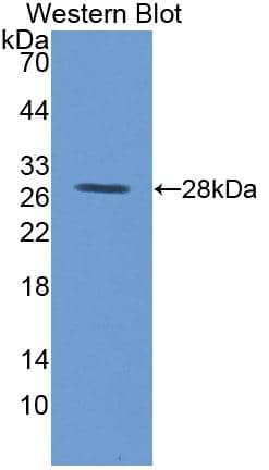 Western Blot: MYH Antibody [NBP3-41361] - Sample: Recombinant protein.