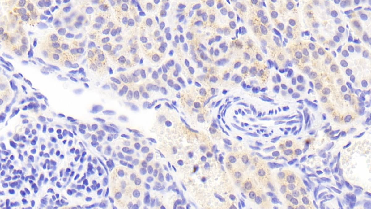 Immunohistochemistry-Paraffin Lgi3 Antibody