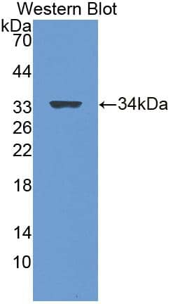 Western Blot Lgi3 Antibody