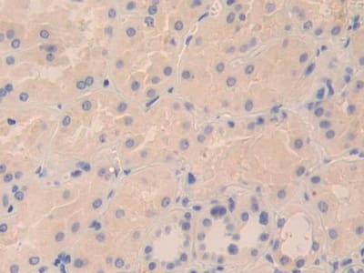 Immunohistochemistry-Paraffin: TPSD1 Antibody [NBP3-41363] - DAB staining on IHC-P; Samples: Human Kidney Tissue; Primary Ab: 10ug/ml NBP3-41363; Second Ab: 2ug/mL HRP-Linked Caprine Anti-Rabbit IgG Polyclonal Antibody