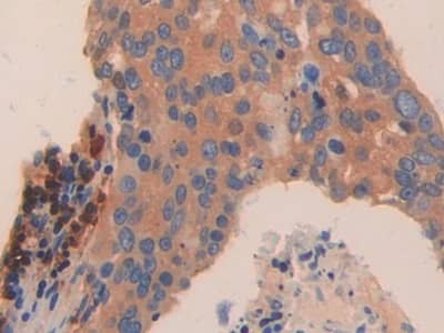 Immunohistochemistry-Paraffin: TPSD1 Antibody [NBP3-41363] - DAB staining on fromalin fixed paraffin-embedded Bowels tissue