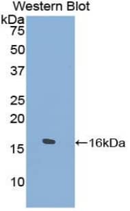 Western Blot: TPSD1 Antibody [NBP3-41363] - Sample: Recombinant protein.