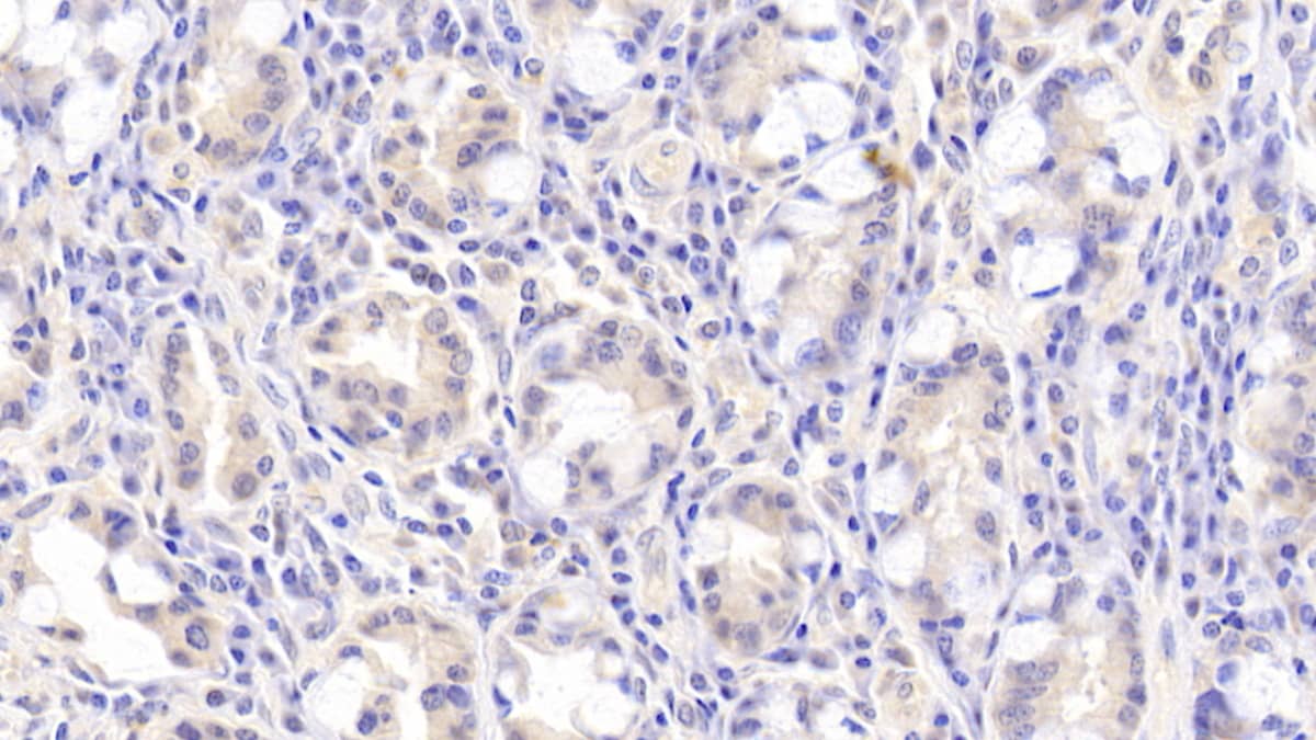Immunohistochemistry-Paraffin: FLRT3 Antibody [NBP3-41366] - DAB staining on IHC-P; Samples: Human Small intestine Tissue; Primary Ab: 20ug/ml NBP3-41366; Second Ab: 2ug/mL HRP-Linked Caprine Anti-Rabbit IgG Polyclonal Antibody