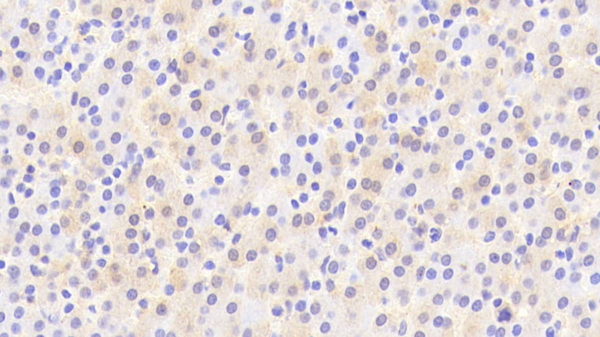 Immunohistochemistry-Paraffin ARSF Antibody