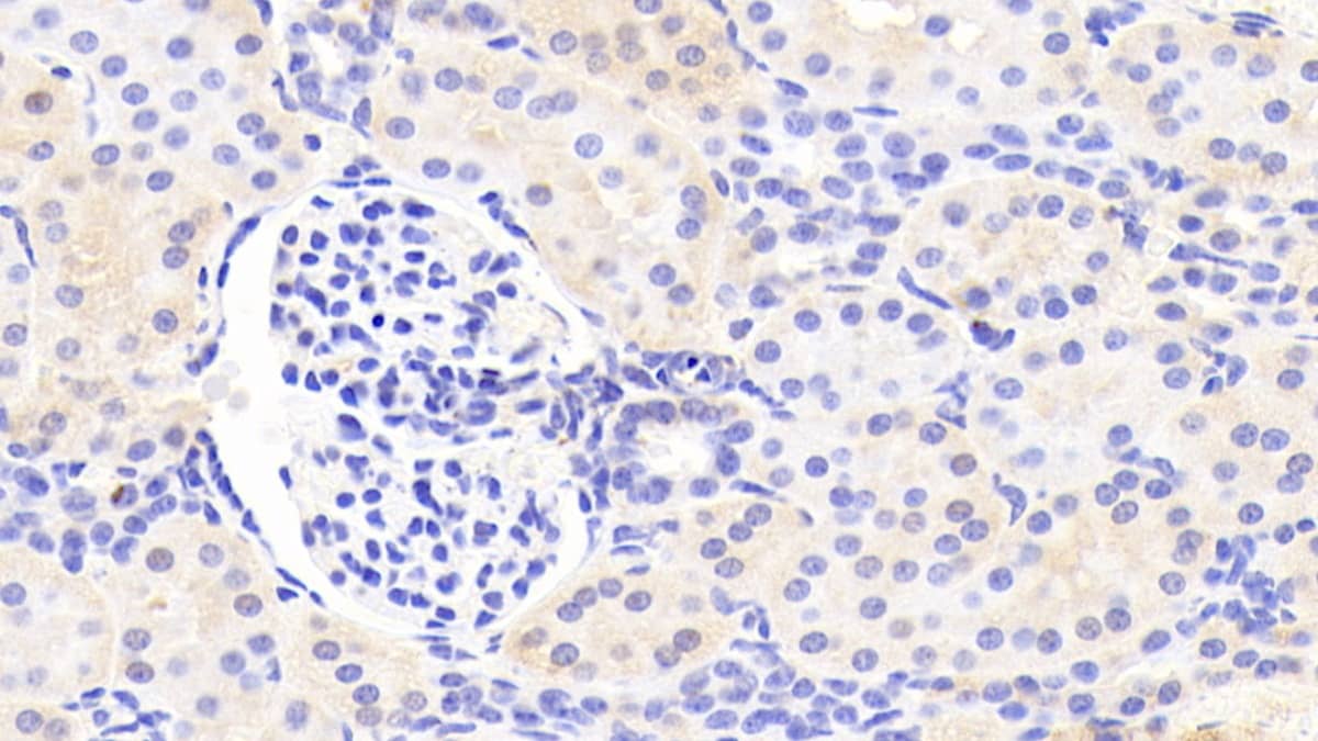 Immunohistochemistry-Paraffin ARSF Antibody