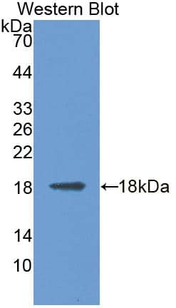 Western Blot MAN2B1 Antibody