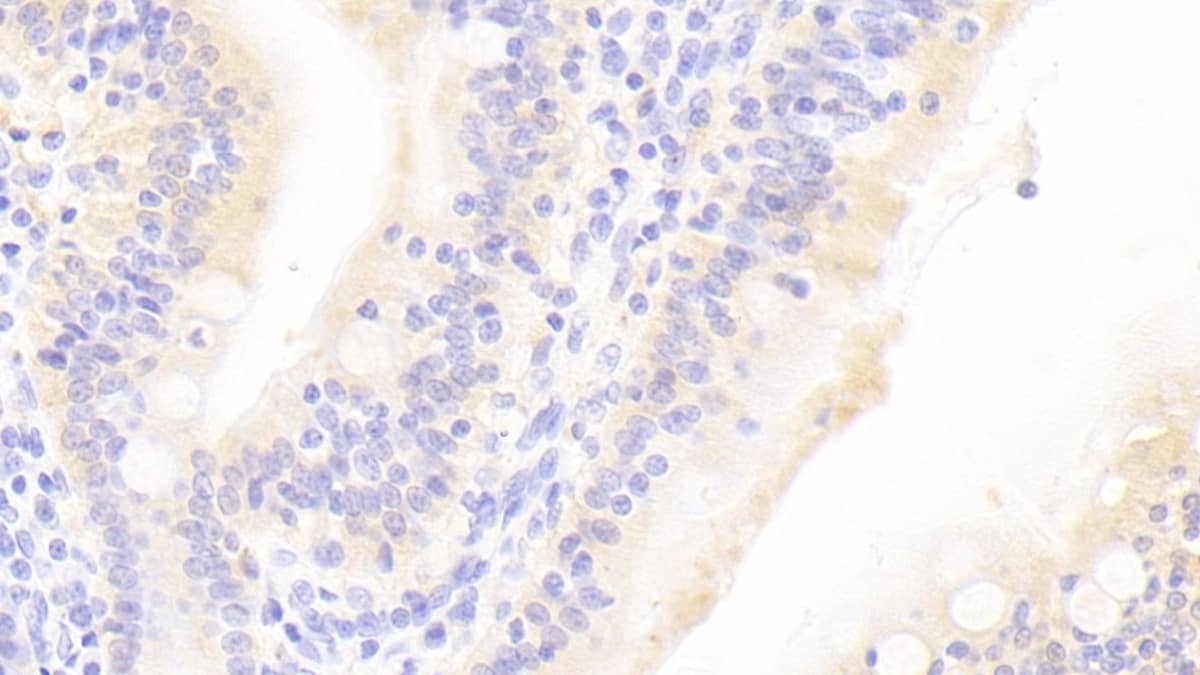 Immunohistochemistry-Paraffin TAS2R38 Antibody