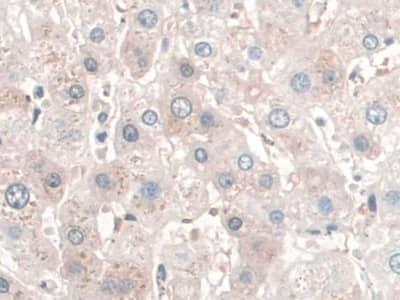 Immunohistochemistry-Paraffin SPAG1 Antibody