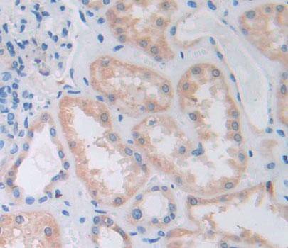 Immunohistochemistry-Paraffin: PTPN7 Antibody [NBP3-41375] - Used in DAB staining on fromalin fixed paraffin- embedded Kidney tissue