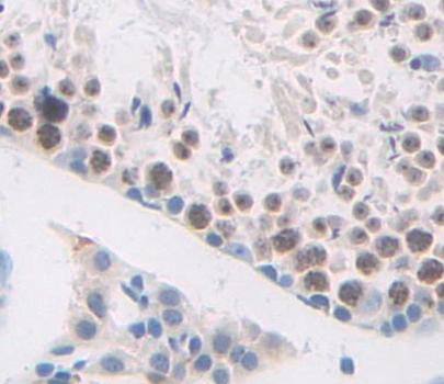 Immunohistochemistry-Paraffin HMGB4 Antibody - BSA Free