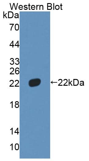 Western Blot: HMGB4 Antibody [NBP3-41377] - Sample: Recombinant protein.