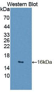 Western Blot GTF2A2 Antibody