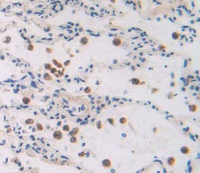 Immunohistochemistry-Paraffin GTF2A2 Antibody