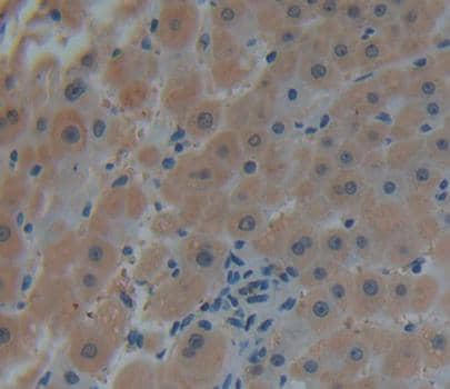 Immunohistochemistry-Paraffin CNRIP1 Antibody