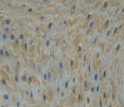 Immunohistochemistry-Paraffin: GBP6 Antibody [NBP3-41382] - Used in DAB staining on fromalin fixed paraffin- embedded esophagus tissue