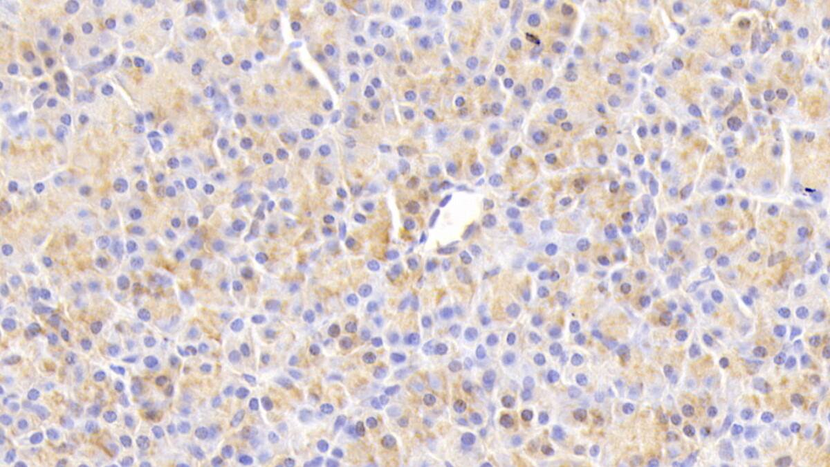 Immunohistochemistry-Paraffin Chemokine-like factor Antibody