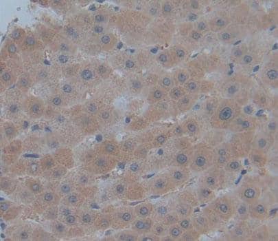 Immunohistochemistry-Paraffin: PMM1/Phosphomannomutase 1 Antibody [NBP3-41397] - Used in DAB staining on fromalin fixed paraffin- embedded Kidney tissue