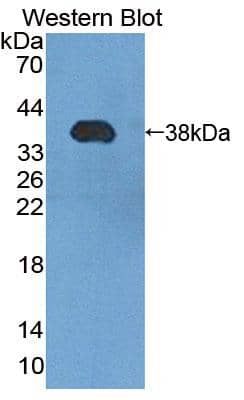 Western Blot: PMM1/Phosphomannomutase 1 Antibody [NBP3-41397] - Sample: Recombinant protein.