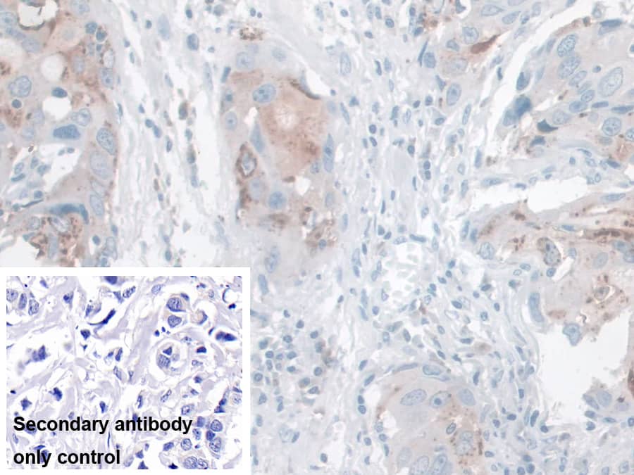 Immunohistochemistry-Paraffin Kallikrein 14 Antibody