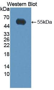 Western Blot: Kallikrein 14 Antibody [NBP3-41399] - Sample: Recombinant Kallikrein 14, Human.