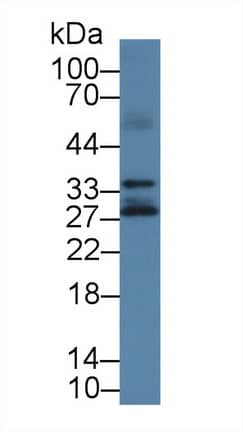 Western Blot: Kallikrein 14 Antibody [NBP3-41399] - Sample: Human Lung lysate; Primary Ab: 1ug/ml NBP3-41399; Second Ab: 0.2ug/mL HRP-Linked Caprine Anti-Rabbit IgG Polyclonal Antibody;