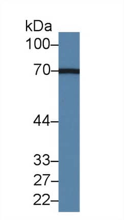 Western Blot Acyloxyacyl Hydrolase Antibody - BSA Free