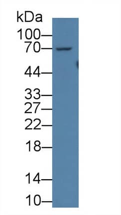 Western Blot Acyloxyacyl Hydrolase Antibody - BSA Free