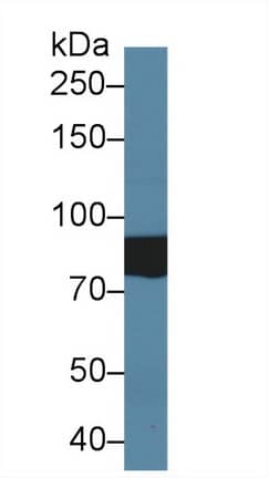 Western Blot: SLC26A8 Antibody [NBP3-41402] - Sample: Human Serum; Primary Ab: 2ug/ml NBP3-41402; Second Ab: 0.2ug/mL HRP-Linked Caprine Anti-Rabbit IgG Polyclonal Antibody