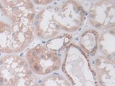 Immunohistochemistry-Paraffin: Isocitrate Dehydrogenase 2/IDH2 Antibody [NBP3-41403] - DAB staining on IHC-P; Samples: Human Kidney Tissue; Primary Ab: 10ug/ml NBP3-41403; Second Ab: 2ug/mL HRP-Linked Caprine Anti-Rabbit IgG Polyclonal Antibody