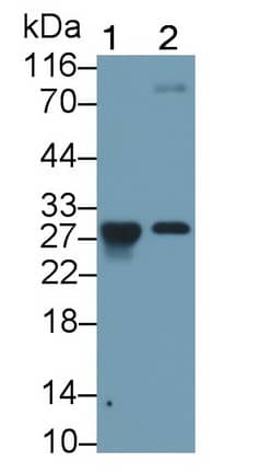 Western Blot: Granzyme K Antibody (C8) [NBP3-41407] - Sample: Lane1: Rat Spleen lysate; Lane2: Rat Lung lysate Primary Ab: 1.5ug/ml NBP3-41407; Second Ab: 0.2ug/mL HRP-Linked Caprine Anti-Mouse IgG Polyclonal Antibody