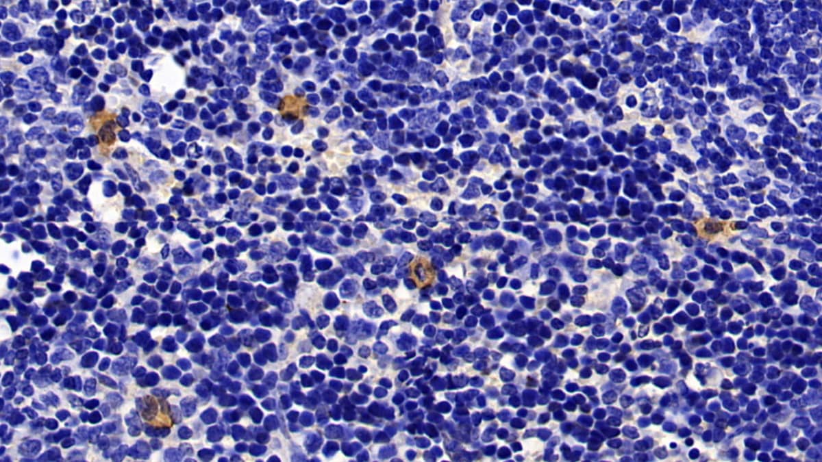 Immunohistochemistry-Paraffin: Granzyme K Antibody (C7) [NBP3-41409] - DAB staining on IHC-P; Sample: Mouse Spleen Tissue; Primary Ab: 30ug/ml NBP3-41409; Second Ab: 2ug/mL HRP-Linked Caprine Anti-Mouse IgG Polyclonal Antibody