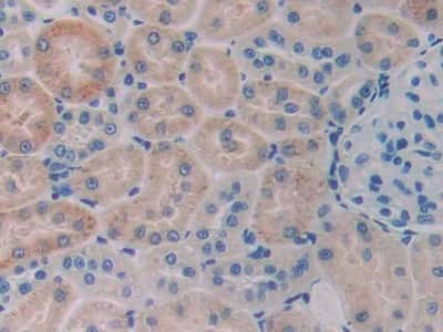 Immunohistochemistry-Paraffin: Serpin A6/Cortisol Binding Globulin Antibody (C7) [NBP3-41410] - DAB staining on IHC-P; Samples: Rat Kidney Tissue; Primary Ab: 40ug/ml NBP3-41410