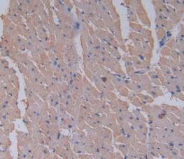 Immunohistochemistry-Paraffin: Serpin A6/Cortisol Binding Globulin Antibody (C7) [NBP3-41410] - DAB staining on IHC-P; Samples: Rat Heart Tissue