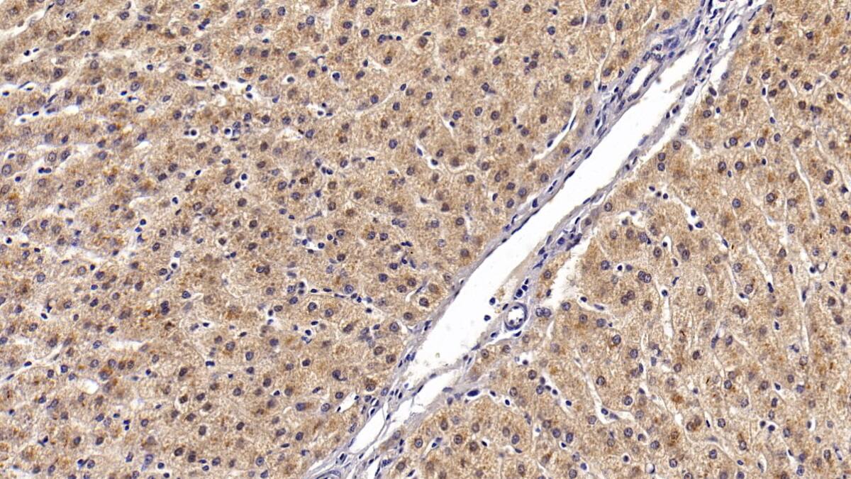 Immunohistochemistry-Paraffin: Angiostatin Antibody (C36) [NBP3-41411] - DAB staining on IHC-P; Sample: Human Liver Tissue; Primary Ab: 20ug/ml NBP3-41411; Second Ab: 2ug/mL HRP-Linked Caprine Anti-Mouse IgG Polyclonal Antibody