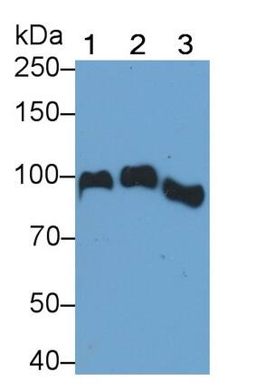 Western Blot: Angiostatin Antibody (C36) [NBP3-41411] - Sample: Lane1: Human Serum; Lane2: Human Plasma; Lane2: Human Placenta lysate Primary Ab: 0.04ug/ml NBP3-41411; Second Ab: 0.2ug/mL HRP-Linked Caprine Anti-Mouse IgG Polyclonal Antibody