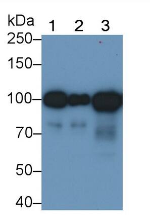 Western Blot: Angiostatin Antibody (C5) [NBP3-41412] - Sample: Lane1: Human Serum; Lane2: Human Plasma; Lane2: Human Placenta lysate Primary Ab: 0.04ug/ml NBP3-41412; Second Ab: 0.2ug/mL HRP-Linked Caprine Anti-Mouse IgG Polyclonal Antibody