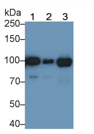 Western Blot: Angiostatin Antibody (C7) [NBP3-41413] - Sample: Lane1: Human Serum; Lane2: Human Plasma; Lane2: Human Placenta lysate Primary Ab: 0.04ug/ml NBP3-41413; Second Ab: 0.2ug/mL HRP-Linked Caprine Anti-Mouse IgG Polyclonal Antibody