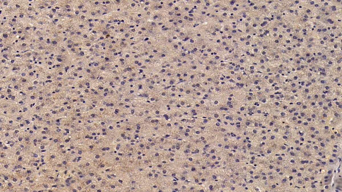 Immunohistochemistry-Paraffin Angiostatin Antibody (D3)