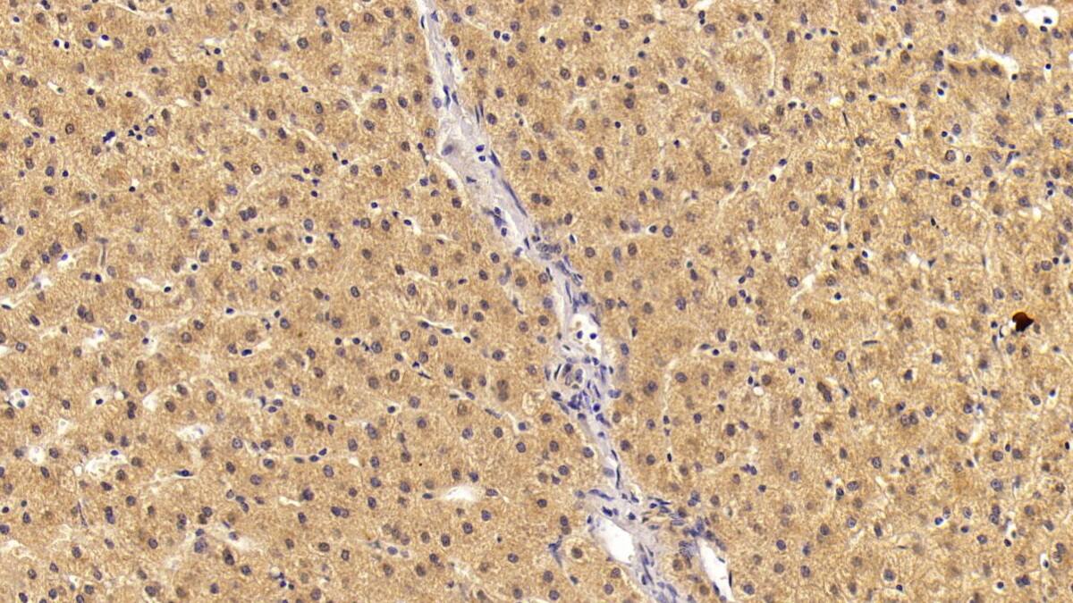 Immunohistochemistry-Paraffin: Angiostatin Antibody (C34) [NBP3-41415] - DAB staining on IHC-P; Sample: Human Liver Tissue; Primary Ab: 10ug/ml NBP3-41415; Second Ab: 2ug/mL HRP-Linked Caprine Anti-Mouse IgG Polyclonal Antibody