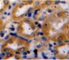 Immunohistochemistry-Paraffin: COL15A1 Antibody [NBP3-41416] - Used in DAB staining on fromalin fixed paraffin-embedded Kidney tissue