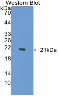 Western Blot: COL15A1 Antibody [NBP3-41416] - Sample: Recombinant protein.