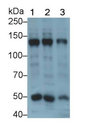 Western Blot Collagen IV alpha5 Antibody