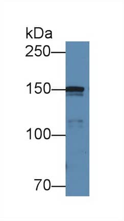 Western Blot Collagen IV alpha5 Antibody