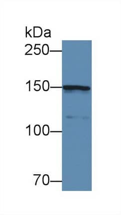 Western Blot Collagen IV alpha5 Antibody