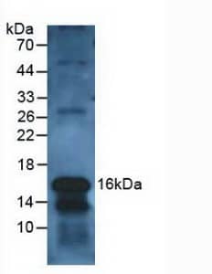 Western Blot: Galectin-10 Antibody [NBP3-41419] - Sample: Human Leukocyte Cells.