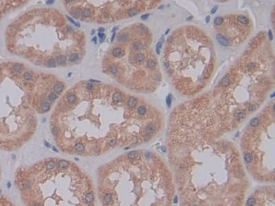 Immunohistochemistry-Paraffin: Galectin-10 Antibody [NBP3-41419] - DAB staining on IHC-P; Samples: Human Kidney Tissue; Primary Ab: 30ug/ml NBP3-41419; Second Ab: 2ug/mL HRP-Linked Caprine Anti-Rabbit IgG Polyclonal Antibody