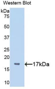 Western Blot: PLAGL1 Antibody [NBP3-41420] - Sample: Recombinant protein.